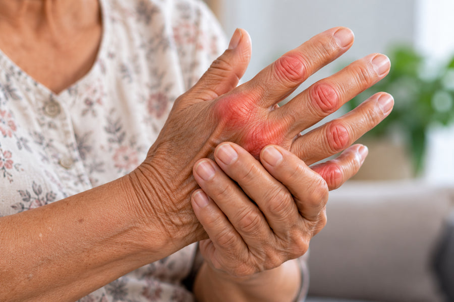 Arthritis pain