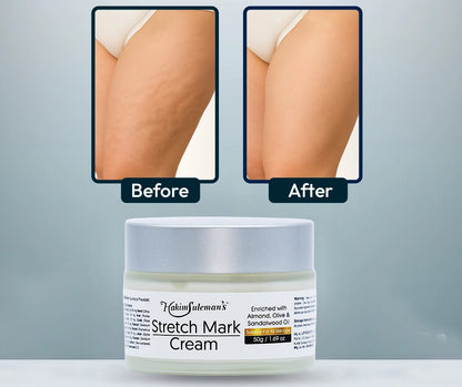 Stretch Mark Cream
