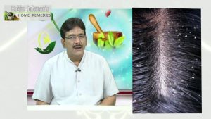 Cure Dandruff with Desi Ghee