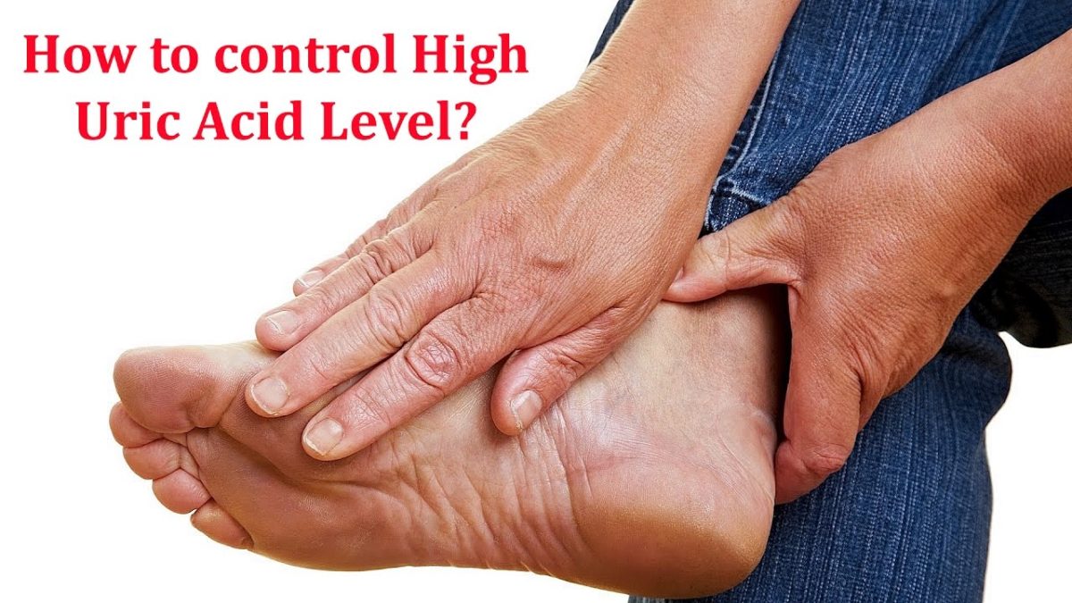 How To Control High Uric Acid Level? - Hakeem Suleman Khan