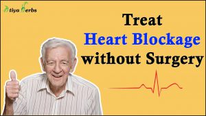 How to treat Heart Blockage without Surgery