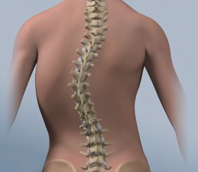 back pain