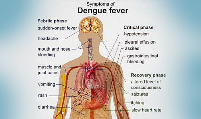 Symptoms of Dengue