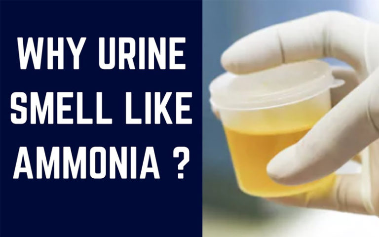 Foul Smell in Urine